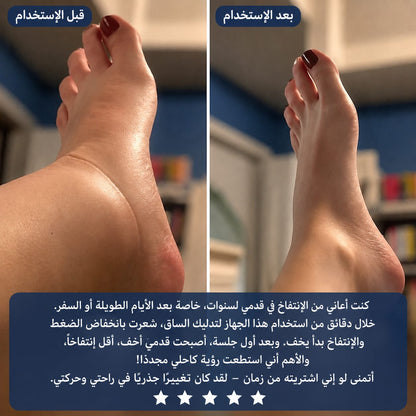 جهاز ازالة السوائل في الرجل